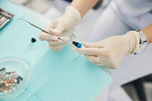 Quelle est la durée de vie d'un plombage dentaire à Gatineau-Hull ?